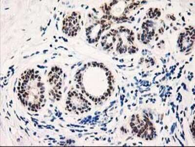 Immunohistochemistry: PIG3 Antibody (OTI3B11) - Azide and BSA Free [NBP2-73400]