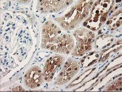 Immunohistochemistry: PIG3 Antibody (OTI3B11) - Azide and BSA Free [NBP2-73400]