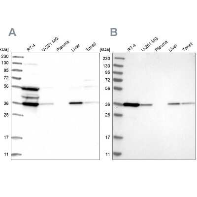 Western Blot: PIG3 Antibody [NBP1-87274]