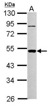 Western Blot: PIGA Antibody [NBP2-19827]