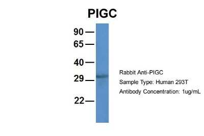 Western Blot: PIGC Antibody [NBP1-79871]
