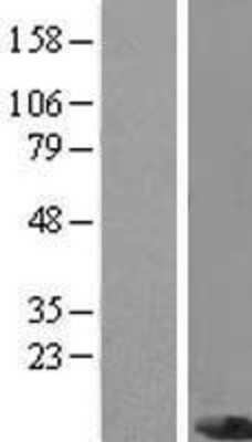 Western Blot: PIGC Overexpression Lysate [NBP2-08086]