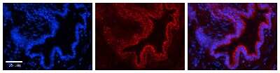 Immunohistochemistry: PIGF Antibody [NBP1-69261]