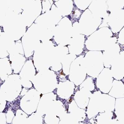 Immunohistochemistry-Paraffin: PIGF Antibody [NBP2-49003]