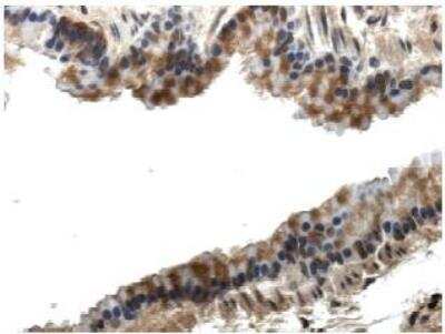 Immunohistochemistry: PIGF Antibody (RM0010-8F09) - Azide and BSA Free [NB110-85468]