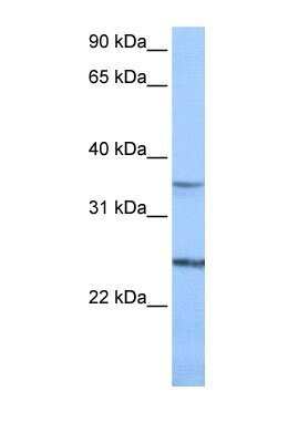 Western Blot: PIGF Antibody [NBP1-69261]