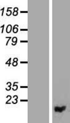 Western Blot: PIGF Overexpression Lysate [NBP2-08087]