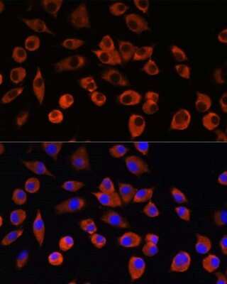 Immunocytochemistry/ Immunofluorescence: PIGM Antibody - Azide and BSA Free [NBP2-94070]