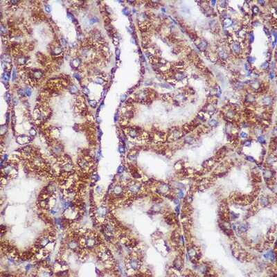 Immunohistochemistry-Paraffin: PIGM Antibody - Azide and BSA Free [NBP2-94070]