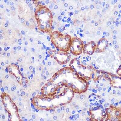 Immunohistochemistry-Paraffin: PIGM Antibody - Azide and BSA Free [NBP2-94070]