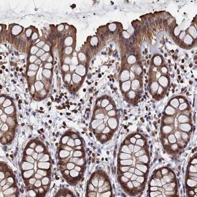 Immunocytochemistry/ Immunofluorescence: PIGN Antibody [NBP1-81248]