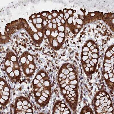 Immunohistochemistry-Paraffin: PIGN Antibody [NBP1-81249]