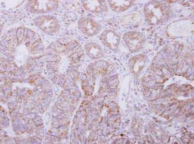 Immunohistochemistry-Paraffin: PIGO Antibody [NBP2-19828]