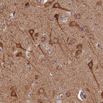 Immunohistochemistry-Paraffin: PIGQ Antibody [NBP1-83343]