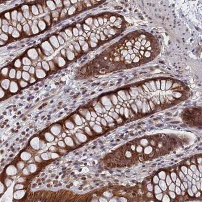 Immunohistochemistry-Paraffin: PIGQ Antibody [NBP1-83344]