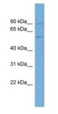 Western Blot: PIGQ Antibody [NBP1-59738]