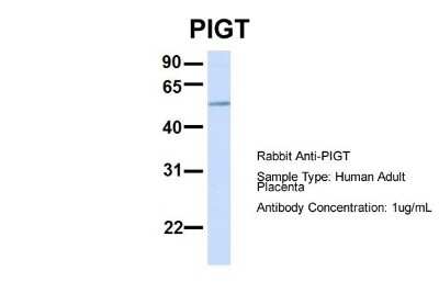Western Blot: PIGT Antibody [NBP1-69642]