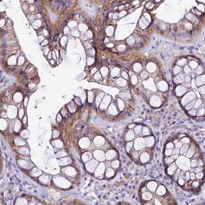 Immunohistochemistry-Paraffin: PIGU Antibody [NBP2-30386]