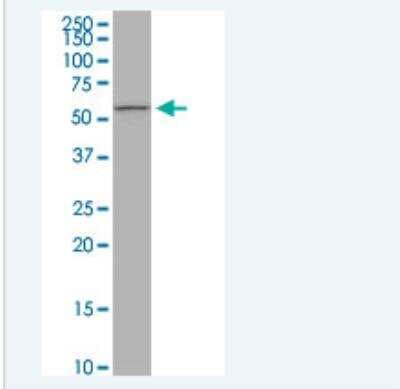 Western Blot: PIGW Antibody (1D8) [H00284098-M05-100ug]