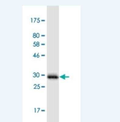 Western Blot: PIGW Antibody (1D8) [H00284098-M05-100ug]