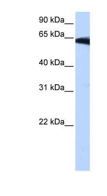 Western Blot: PIGW Antibody [NBP1-60017]