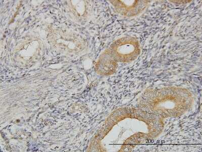 Immunohistochemistry-Paraffin: PIH1D1 Antibody (1E8) [H00055011-M06]