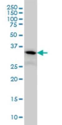 Western Blot: PIH1D1 Antibody (1E8) [H00055011-M06]
