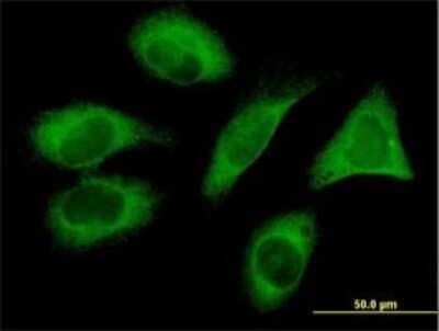 Immunocytochemistry/ Immunofluorescence: PIH1D1 Antibody (1G6) [H00055011-M04]