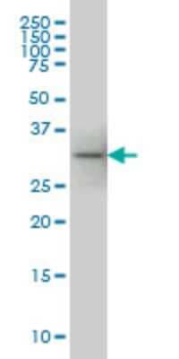 Western Blot: PIH1D1 Antibody (1G6) [H00055011-M04]