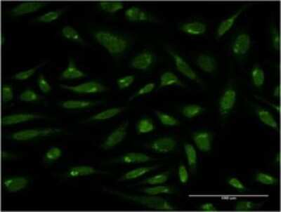 Immunocytochemistry/ Immunofluorescence: PIH1D1 Antibody (4F5-1E10) [H00055011-M01]
