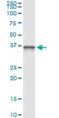 Immunoprecipitation: PIH1D1 Antibody (4F5-1E10) [H00055011-M01]