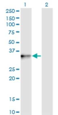 Western Blot: PIH1D1 Antibody (4F5-1E10) [H00055011-M01]