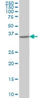 Western Blot: PIH1D1 Antibody (4H7) [H00055011-M02]