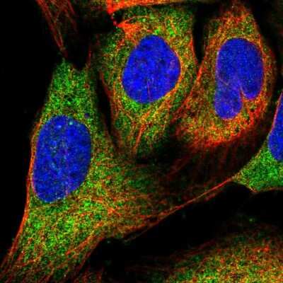 Immunocytochemistry/ Immunofluorescence: PIH1D1 Antibody [NBP1-92269]
