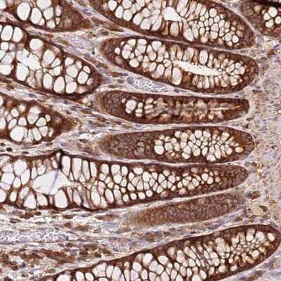 Immunohistochemistry-Paraffin: PIH1D1 Antibody [NBP1-92269]