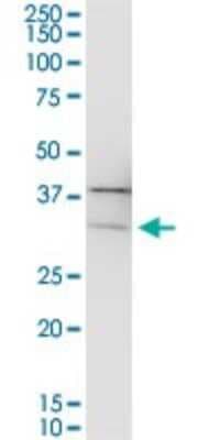 Western Blot: PIH1D1 Antibody [H00055011-B01P]