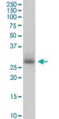 Western Blot: PIH1D1 Antibody [H00055011-B01P]