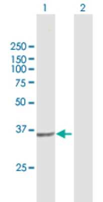 Western Blot: PIH1D1 Antibody [H00055011-B01P]