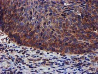 Immunohistochemistry: PIH1D2 Antibody (OTI4A10) - Azide and BSA Free [NBP2-73403]