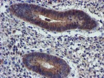 Immunohistochemistry: PIH1D2 Antibody (OTI4A10) - Azide and BSA Free [NBP2-73403]