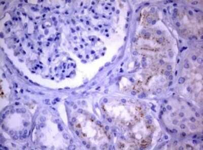 Immunohistochemistry: PIK3C2A Antibody (OTI3H2) [NBP2-46395]