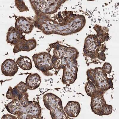Immunohistochemistry-Paraffin: PIK3C2A Antibody [NBP1-80908]