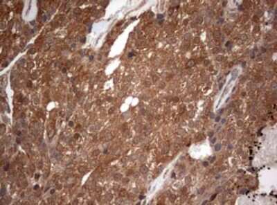 Immunohistochemistry: PIK3CA Antibody (OTI6D9) [NBP2-46403]