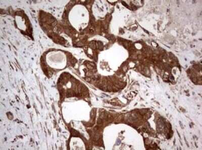 Immunohistochemistry: PIK3CA Antibody (OTI6D9) [NBP2-46403]