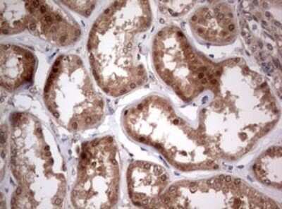 Immunohistochemistry: PIK3CA Antibody (OTI6D9) [NBP2-46403]