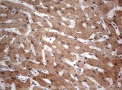 Immunohistochemistry: PIK3CA Antibody (OTI6D9) [NBP2-46403]