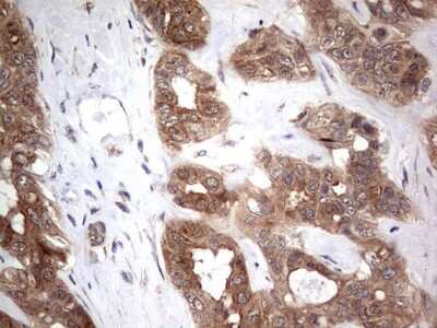 Immunohistochemistry: PIK3CA Antibody (OTI6D9) [NBP2-46403]