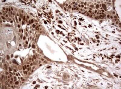 Immunohistochemistry: PIK3CA Antibody (OTI6D9) [NBP2-46403]