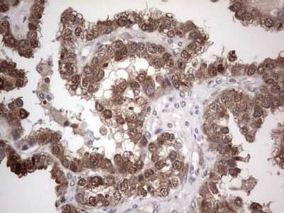 Immunohistochemistry: PIK3CA Antibody (OTI6D9) [NBP2-46403]