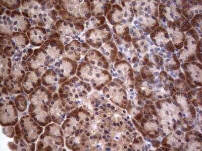 Immunohistochemistry: PIK3CA Antibody (OTI6D9) [NBP2-46403]